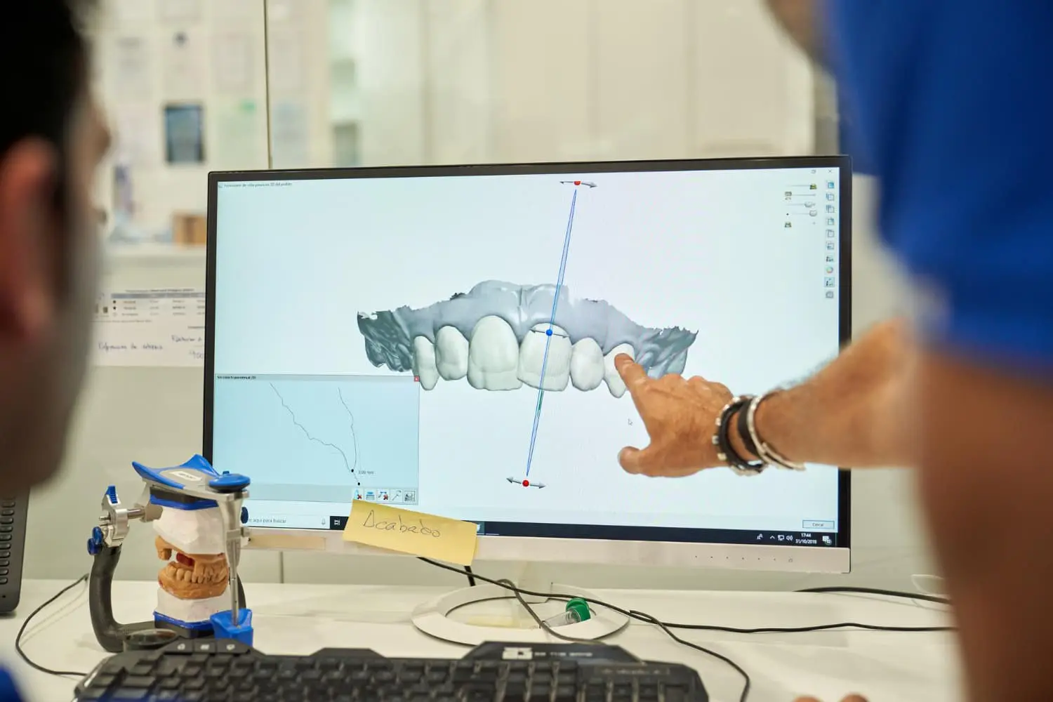 A person points at a computer screen displaying a digital dental model with metal braces, with a dental impression mold on the desk nearby in Jacksonville, FL.