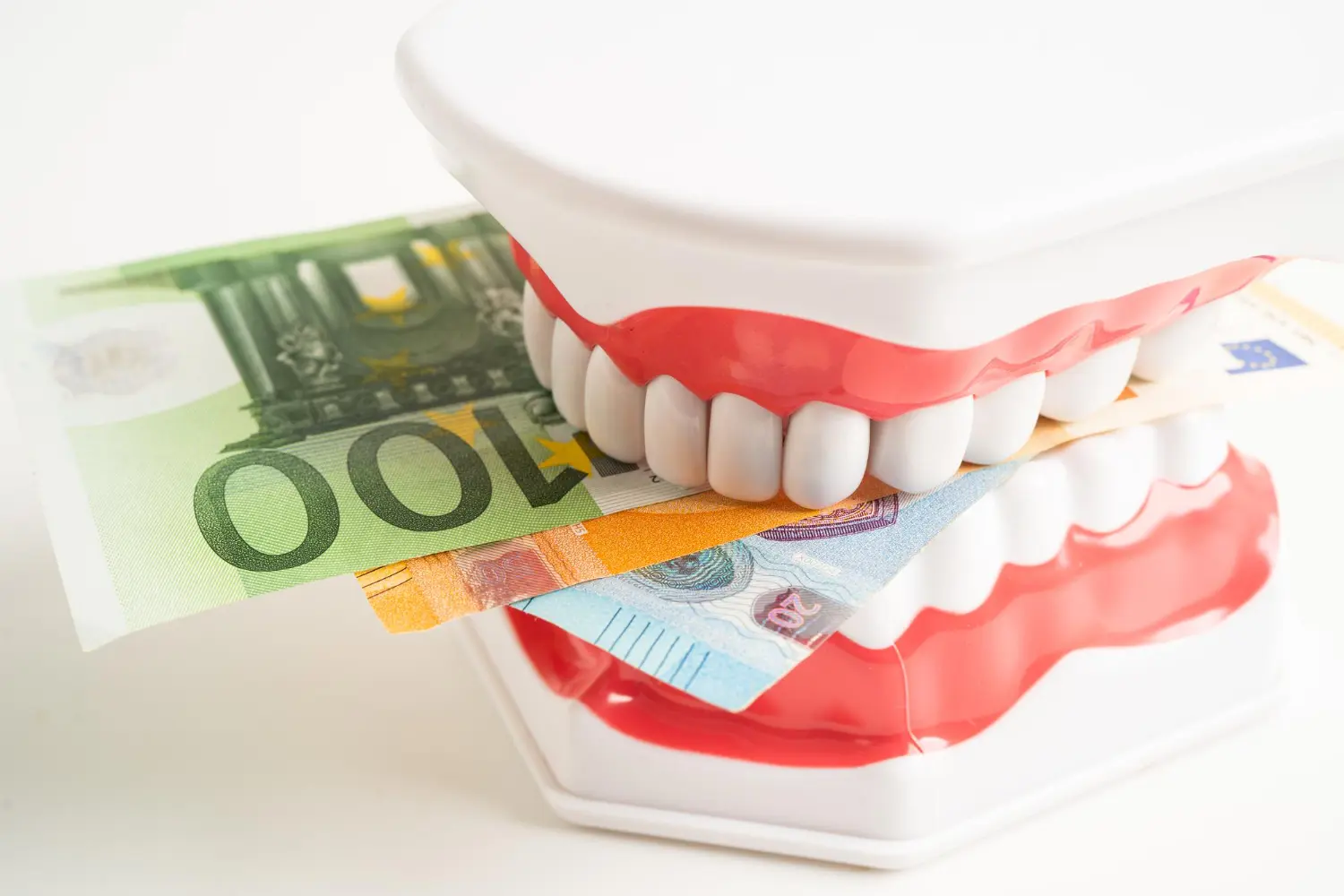 A set of toy chattering teeth with metal braces holds a 100 Euro banknote between its teeth on a white background in Jacksonville, FL.