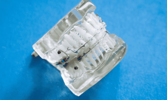 A transparent mechanical component with a ribbed structure, small wires, and metal braces against a blue background in Jacksonville, FL.