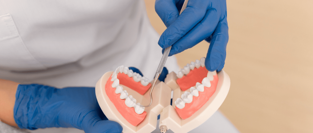 A person wearing blue gloves uses a dental instrument on a model of human teeth and gums that demonstrates an overbite. This scene is set in Jacksonville, FL.