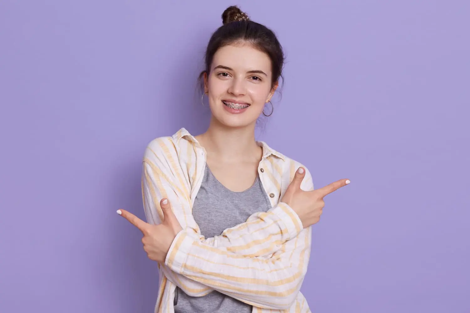 In Jacksonville FL, a young woman with braces, wearing a striped shirt over a gray t-shirt, stands in front of a purple background and points to the sides, proudly showing her progress in correcting an underbite.