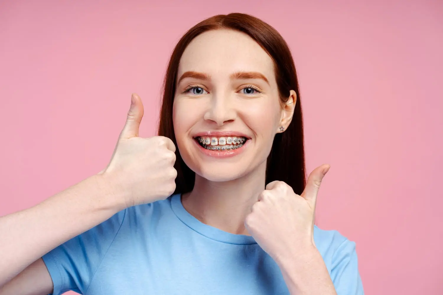 A cheerful person with red hair and braces gives a double thumbs-up against a pink background. Considering braces near you in Jacksonville, FL? This image highlights the positive experience of orthodontic treatment.