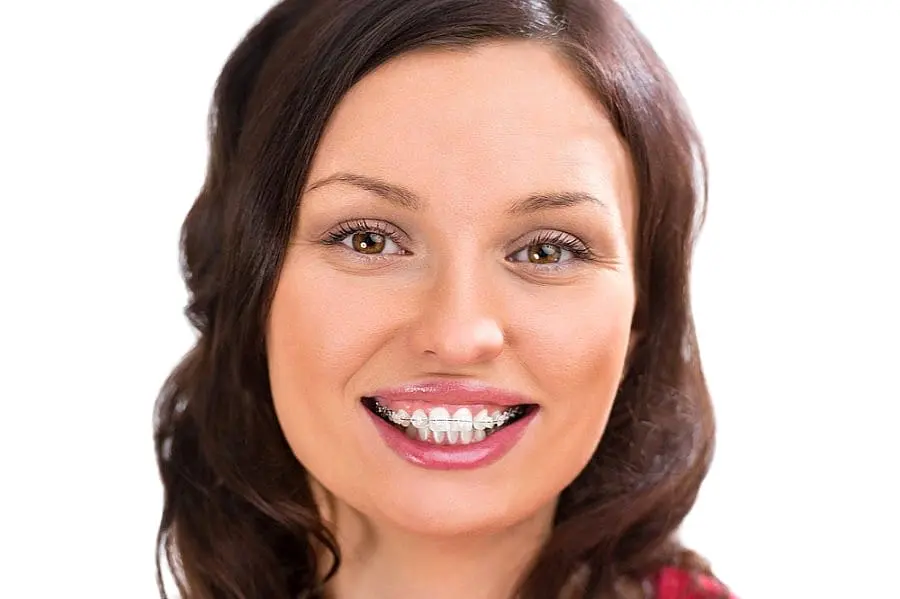 A woman with brown hair smiles while wearing metal braces on her teeth, photographed against a white background, possibly comparing options like ceramic braces in Jacksonville, FL.