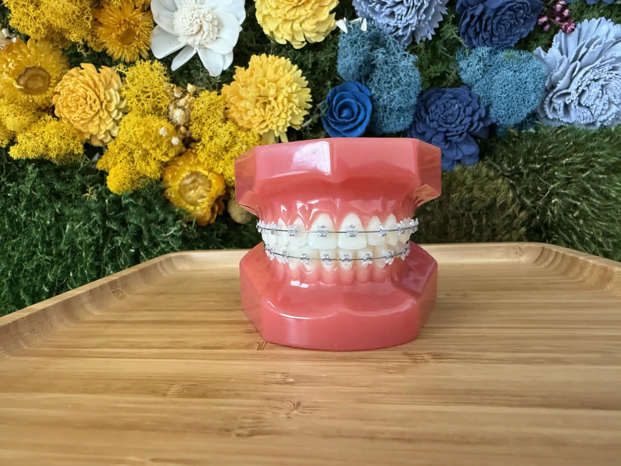 On a wooden tray, a dental model with ceramic braces represents Bold Bite Orthodontics in Jacksonville FL, with floral decor behind.