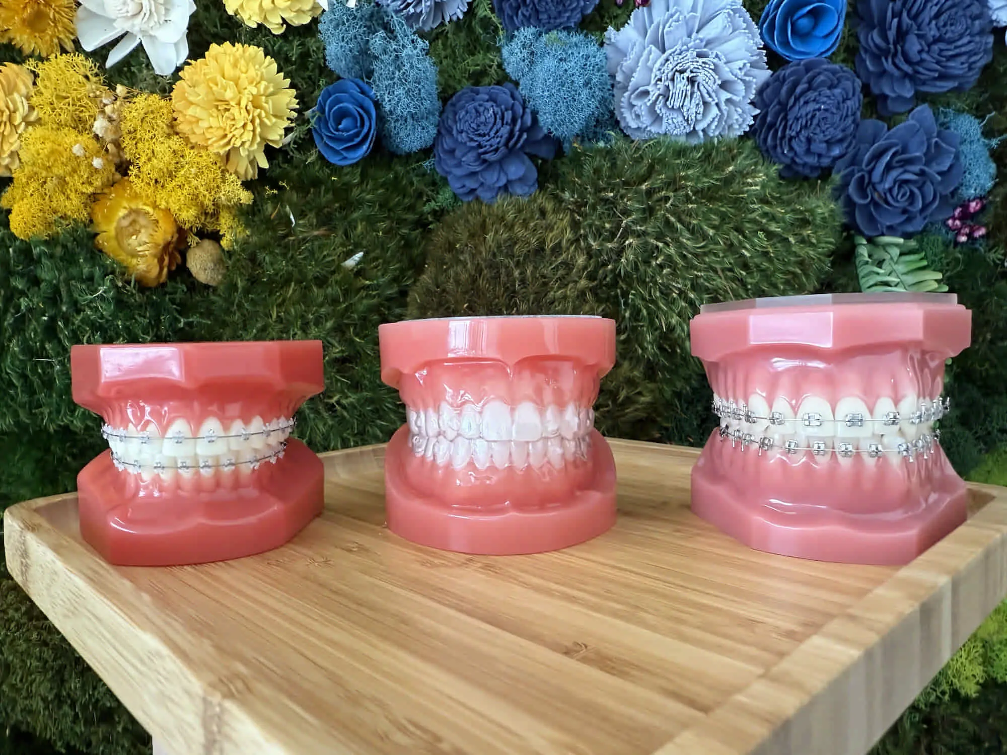 Three dental models showcasing different types of braces: metal braces, clear aligners, and ceramic or metal braces with brackets, possibly representing options available in Jacksonville, FL.